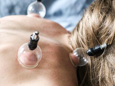 https://staging.citywellbrooklyn.com/wp-content/uploads/2019/07/cityWell_acupuncture_cupping-400x300.jpg